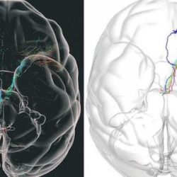 صورة عالية الدقة لدماغ قرد تمهد الطريق لعلاج الشلل الرعاش