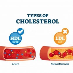 خبير يكشف مفهوم الكوليسترول الضار والجيد بالغذاء